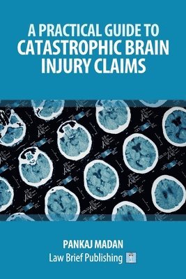Pankaj Madan - Practical Guide to Catastrophic Brain Injury Claims, Häftad