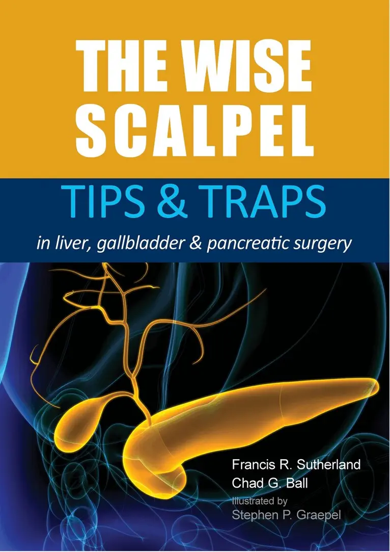 Francis Sutherland, Chad G. Ball - The Wise Scalpel, E-bok. Tillgänglighet: Lägg i varukorg