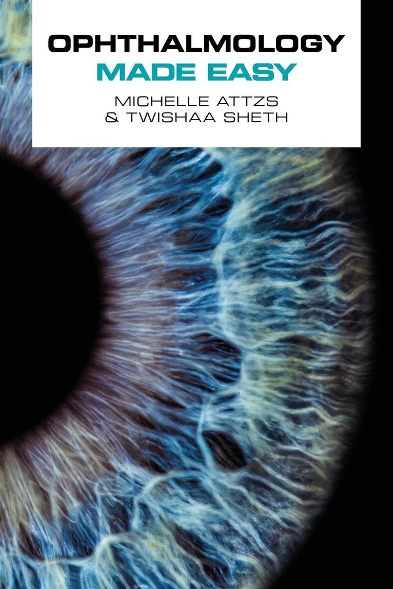 Michelle Attzs, Twishaa Sheth - Ophthalmology Made Easy, Häftad. Tillgänglighet: Lägg i varukorg