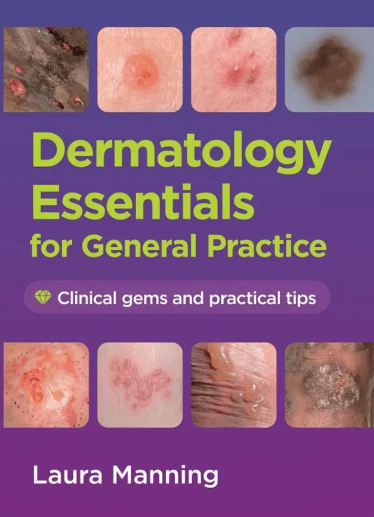 Laura Manning - Dermatology Essentials for General Practice, Häftad. Tillgänglighet: Lägg i varukorg