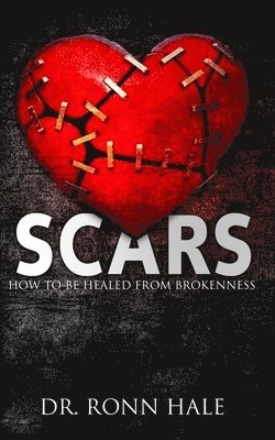 Ronn Hale - Scars: How to Be Healed from Brokenness, Häftad