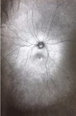 Toril Johannessen - Supplement 3: The Invention and Conclusion of the Eye, Häftad