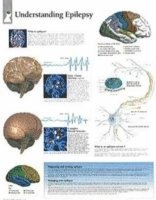Scientific Publishing - Understanding Epilepsy Laminated Poster, Övrigt