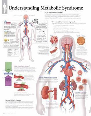 Scientific Publishing - Understanding Metabolic Syndrome Paper Poster, Övrigt