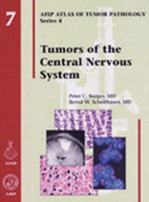 Peter C. Burger, Bernd W. Scheithauer - Tumors of the Central Nervous System, Inbunden. Tillgänglighet: Tillfälligt slut