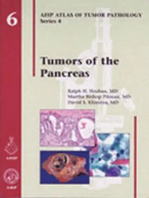 Ralph H. Hruban, Martha Bishop Pitman, David S. Klimstra - Tumors of the Pancreas, Inbunden. Tillgänglighet: Tillfälligt slut