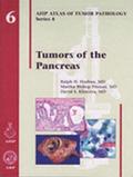 Tumors of the Pancreas