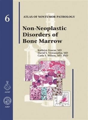Amy Noffsinger, David S. Viswanatha, Carla S. Wilson - Non-Neoplastic Diseases of Bone Marrow, Inbunden. Tillgänglighet: Tillfälligt slut