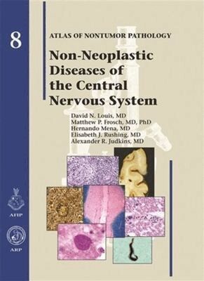 David N. Louis, Matthew P. Frosch, Hernando Mena, Elisabeth J. Rushing, Alexander R. Judkins - Non-Neoplastic Diseases of the Central Nervous System, Inbunden. Tillgänglighet: Tillfälligt slut