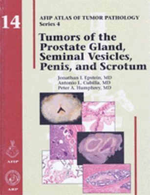 Robert H. Young, John R. Srigley, Mahul B. Amin - Tumors of the Prostate Gland, Seminal Vesicles, Penis, and Scrotum, Inbunden. Tillgänglighet: Tillfälligt slut