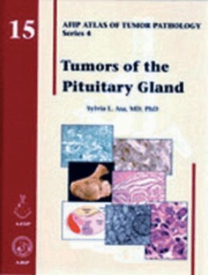 Sylvia L. Asa - Tumors of the Pituitary Gland, Inbunden. Tillgänglighet: Tillfälligt slut