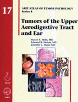Stacey E. Mills, Edward B. Stelow, Jennifer L. Hunt - Tumors of the Upper Aerodigestive Tract and Ear, Inbunden. Tillgänglighet: Tillfälligt slut