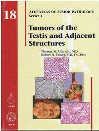 Tumors of the Testis and Adjacent Structures