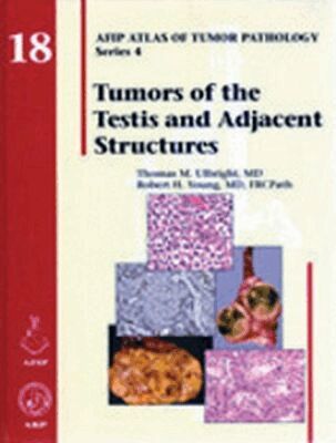 Thomas M. Ulbright, Robert H. Young - Tumors of the Testis and Adjacent Structures, Inbunden. Tillgänglighet: Tillfälligt slut