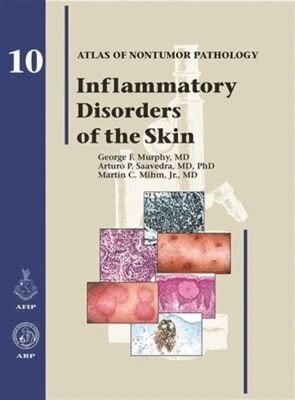 George F. Murphy, Arturo P. Saavedra, Martin C. Mihm Jr - Inflammatory Disorders of the Skin, Inbunden. Tillgänglighet: Tillfälligt slut