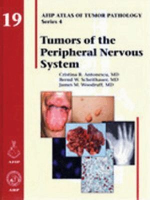 Cristina R. Antonescu, Bernd W. Scheithauer, James M. Woodruff - Tumors of the Peripheral Nervous System, Inbunden. Tillgänglighet: Tillfälligt slut