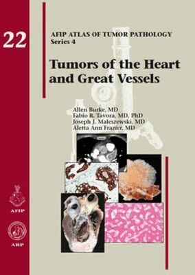 Allen Burke, Fabio R. Tavora, Joseph J. Maleszewski, Aletta Ann Frazier - Tumors of the Heart and Great Vessels, Inbunden. Tillgänglighet: Tillfälligt slut