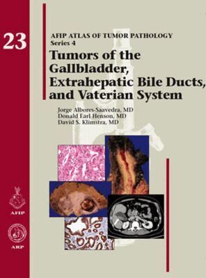 Jorge Albores-Saavedra, Donald Earl Henson, David S. Klimstra - Tumors of the Gallbladder, Extrahepatic Bile Ducts, and Vaterian System, Inbunden. Tillgänglighet: Lägg i varukorg