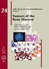 Diagnostic Pathology: Blood and Bone Marrow - Kathryn Foucar - Bok ...