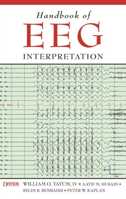 DO William O. Tatum, IV, MD Peter W. Kaplan, MD Aatif M. Husain, MD Selim R. Benbadis - Handbook of EEG Interpretation, E-bok