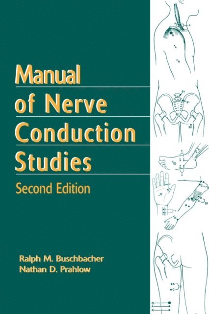 MD Nathan D. Prahlow, MD Ralph Buschbacher - Manual of Nerve Conduction Studies, Second Edition, E-bok. Tillgänglighet: Lägg i varukorg