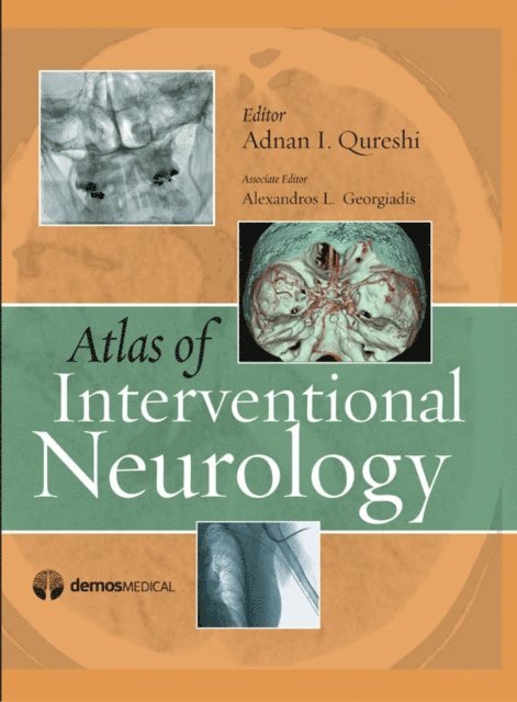 MD Adnan I. Qureshi, MD Alexandros Georgiadis - Atlas of Interventional Neurology, E-bok