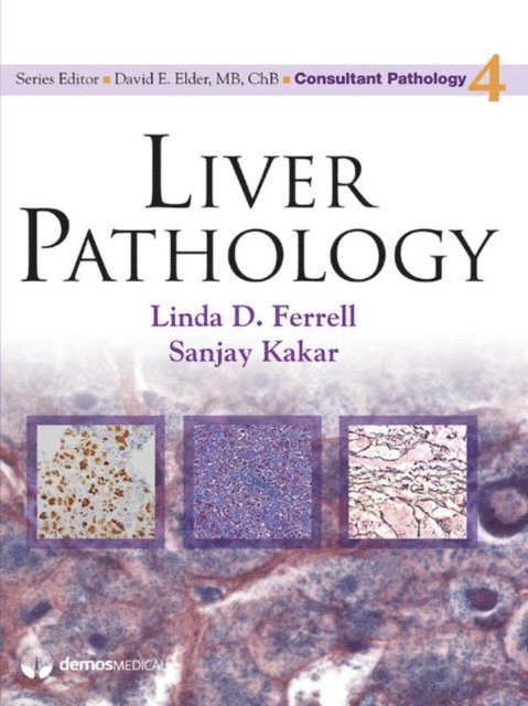 MD Sanjay Kakar, MD Linda D. Ferrell - Liver Pathology, E-bok
