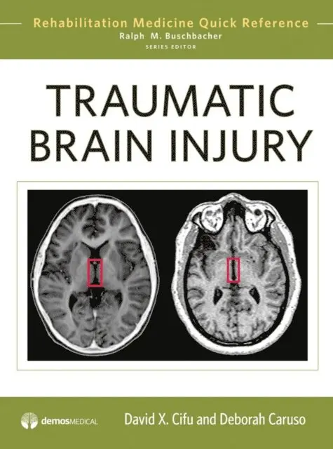 MD David X. Cifu, MD Deborah Caruso - Traumatic Brain Injury, E-bok. Tillgänglighet: Lägg i varukorg