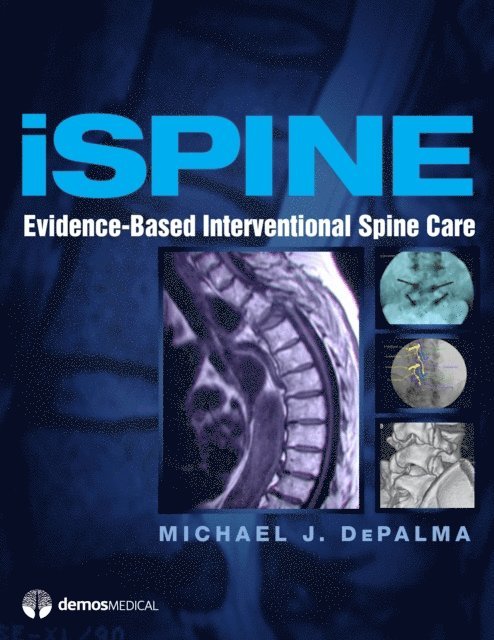 iSpine