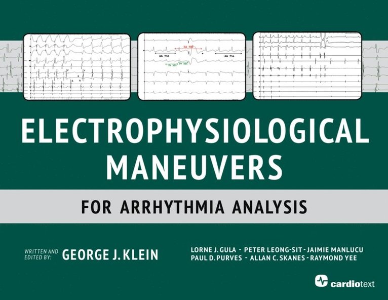 Peter Leong-Sit, Lorne Gula, George Klein - Electrophysiological Maneuvers for Arrhythmia Analysis, E-bok