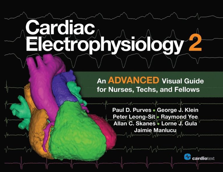 Lorne Gula, George Klein, Paul Purves - Cardiac Electrophysiology 2: An Advanced Visual Guide for Nurses, Techs, and Fellows, E-bok
