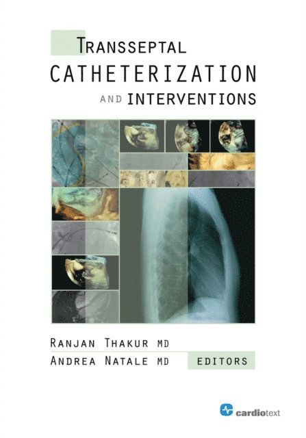Andrea Natale, Ranjan Thakur - Transseptal Catheterization and Interventions, E-bok