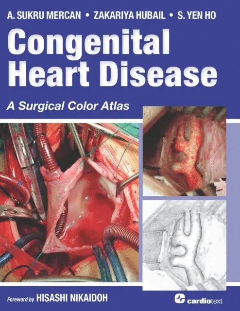 S. Yen Ho, Zakariya Hubail, A. Sukru Mercan - Congenital Heart Disease: A Surgical Color Atlas, E-bok. Tillgänglighet: Lägg i varukorg