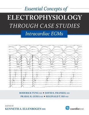 Essential Concepts of Electrophysiology Through Case Studies: Intracardiac EGMs by Kenneth a Ellenbogen, Roderick Tung, David Frankel, Kenneth a