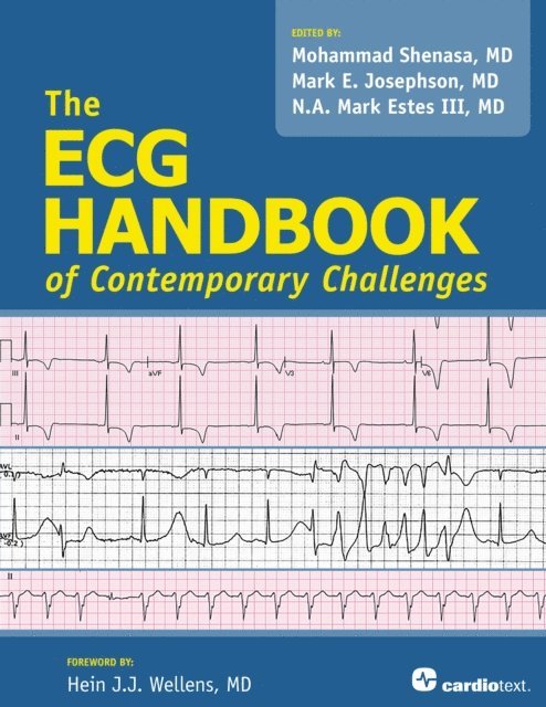 N.A. Mark Estes, Mark Josephson, Mohammad Shenasa - ECG Handbook of Contemporary Challenges, E-bok