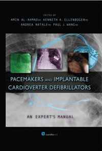 Pacemakers and Implantable Cardioverter Defibrillators: An Expert''s Manual