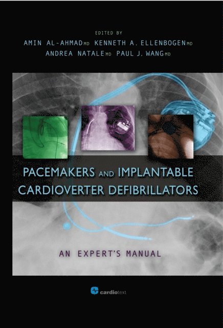 Andrea Natale, Kenneth Ellenbogen, Amin Al-Ahmad - Pacemakers and Implantable Cardioverter Defibrillators: An Expert's Manual, E-bok