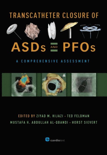 Mustafa H. Abdullah Al-Qbandi, Ted Feldman, Ziyad M. Hijazi - Transcatheter Closure of ASDs and PFOs : A Comprehensive Assessment, E-bok