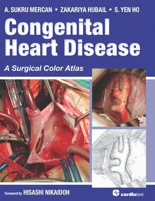 A Sukru Mercan, Zakariya Hubail, S Yen Ho - Congenital Heart Disease, Inbunden. Tillgänglighet: Lägg i varukorg