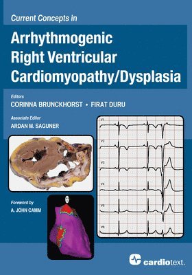 Corinna Brunckhorst, Firat Duru, Ardan M Saguner - Current Concepts in Arrhythmogenic Right Ventricular Cardiomyopathy / Dysplasia, Inbunden
