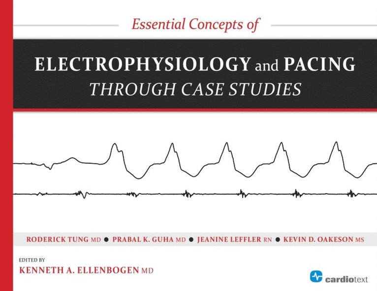 Prabal Guha, Roderick Tung, Kenneth Ellenbogen - Essential Concepts of Electrophysiology and Pacing through Case Studies, E-bok