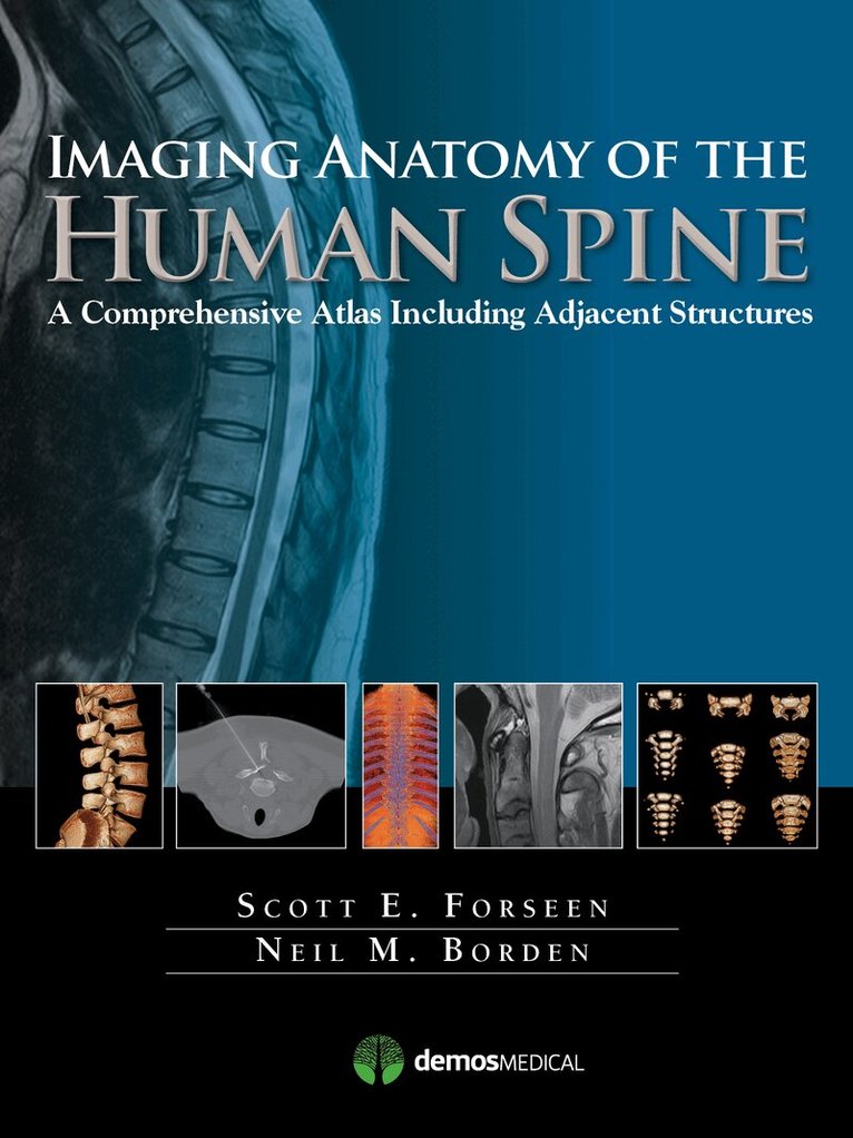 Scott E. Forseen, Neil M. Borden - Imaging Anatomy of the Human Spine, Inbunden
