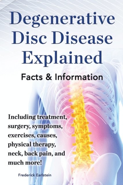 Frederick Earlstein - Degenerative Disc Disease Explained, E-bok