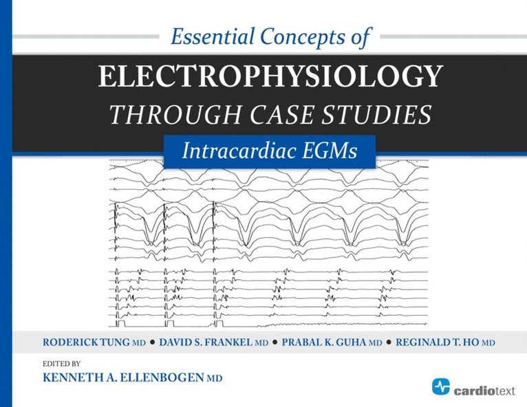 David Frankel, Roderick Tung, Kenneth Ellenbogen - Essential Concepts of Electrophysiology through Case Studies: Intracardiac EGMs, E-bok