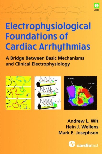 Mark E. Josephson, Hein J. Wellens, Andrew L. Wit - Electrophysiological Foundations of Cardiac Arrhythmias, E-bok