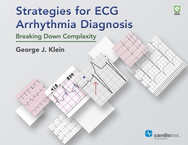 George J. Klein - Strategies for ECG Arrhythmia Diagnosis, E-bok