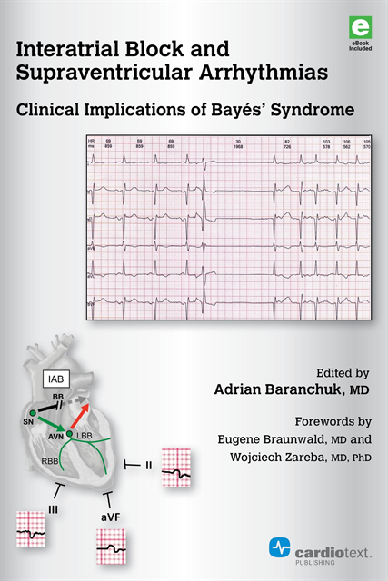 Adrian Baranchuk - Interatrial Block and Supraventricular Arrhythmias: Clinical Implications of Bayes Syndrome, E-bok