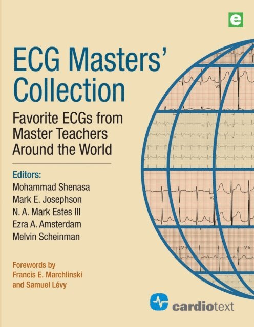 N.A. Mark Estes, Mark E. Josephson, Mohammad Shenasa, Melvin Scheinman, Ezra A. Amsterdam - ECG Masters Collection, E-bok