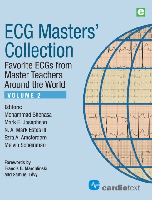 Melvin Scheinman, Ezra A. Amsterdam, N.A. Mark Estes III, Mark E. Josephson, Mohammad Shenasa - ECG Masters Collection Volume 2, E-bok