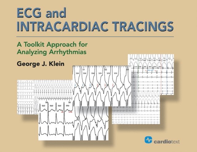 George J. Klein - ECG and Intracardiac Tracings, E-bok